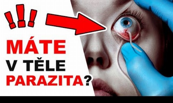 TOP 5 parazitov žijúcich v našom tele