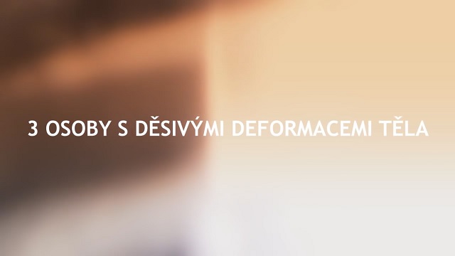 Tri osoby s desivými deformáciami tela