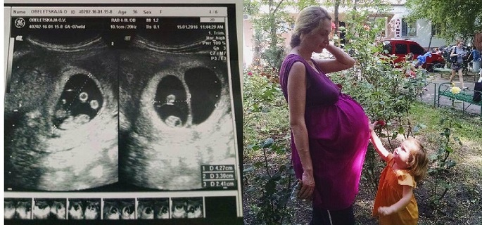 Ultrazvuk tehotnej Ukrajinky ohromil lekárov a skončil úžasne